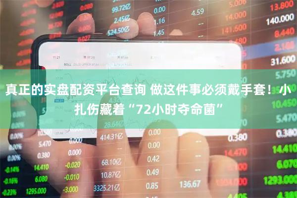真正的实盘配资平台查询 做这件事必须戴手套！小扎伤藏着“72小时夺命菌”